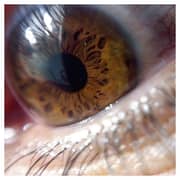 Blips EKBTEP05 Macro Lense Kit Metal Series