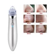 Beauty Device Blackhead Remover
