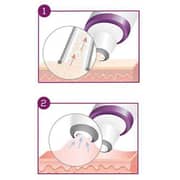 Beurer Facial Micro Dermabration IFC78