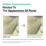 Anua BHA 2% Gentle Exfoliating Face Toner 150ml (Pack of 1)