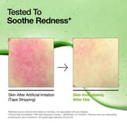 Anua Azelaic Acid 10 Hyaluron Serum