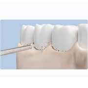 Xiaomi Water Flosser Replacement Tips - MWN505