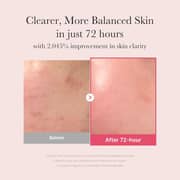 Medicube TXA+Niacinamide 15% Glow Facial Serum Pink