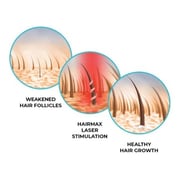 Hairmax Laser band 41 LB410100114