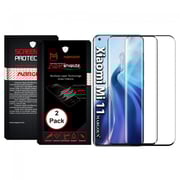 Margoun 2-Pack Xiaomi Mi 11 Screen Protector Tempered Glass Super Shieldz