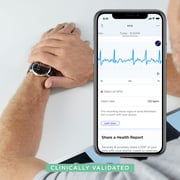 Withings HWA09 Scanwatch Hybrid Smartwatch White