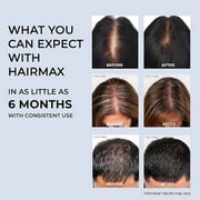 Hairmax Powerflex 272 Laser Cap 50 Watts 1030005