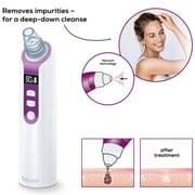 Beurer Electric Blackhead Remover - FC41